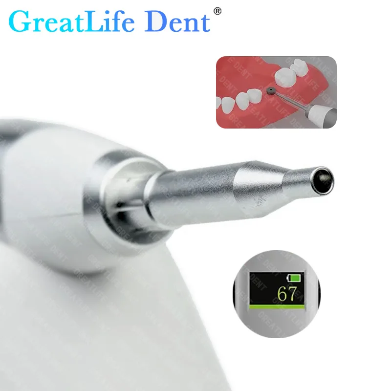 GreatLife Dent ICHECK Dental Implant Stability Meter For Dentist Measurement Implant Stability Resonance Frequency Equipment