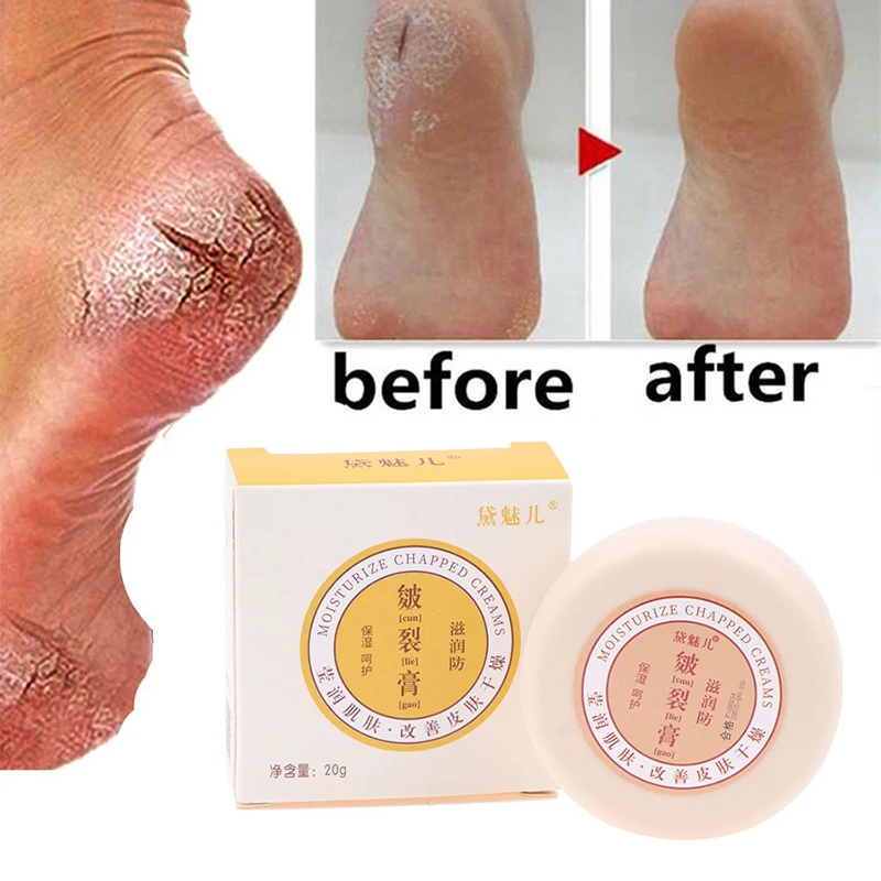 Crème réparatrice pour les pieds, 20g, huile anti-séchage, fissure au talon, élimination de la fréquence, soin de la peau, des mains et des pieds