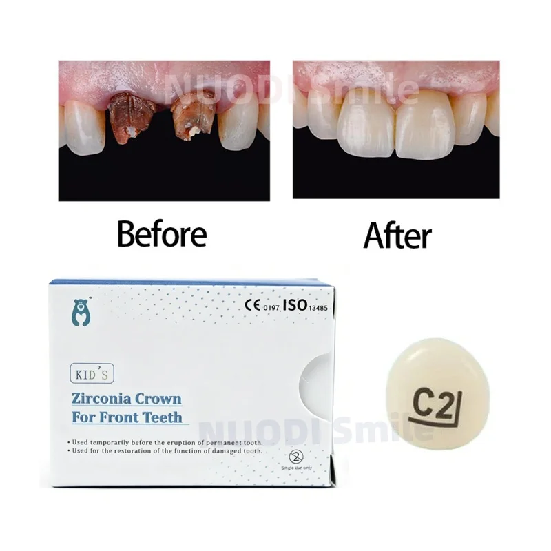 1PC/24PCS Dental Kids Zirconia Crowns Anterior Teeth Preformed Crown Pediatric UL-UR 24 Sizes for Front Teeth Ortho Materials