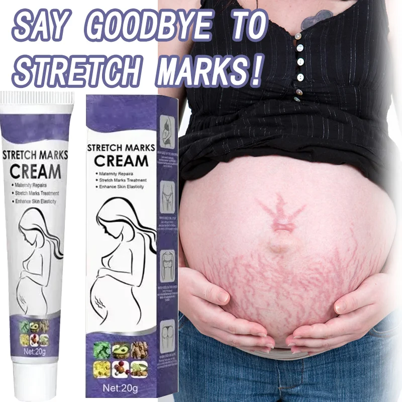 

Stretch Marks Remove Cream Improves Elasticity Effective Remove Marks After Pregnancy Maternity Nourishes Firm Lift Skin Cream
