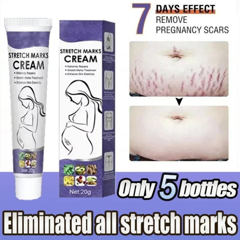 

Gentle Skin Care Improves Elasticity Effective After Pregnancy Stretch Marks Removal Powerful Maternity Cream Nourishes Skin