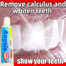 Dental Calculus Remover Cleaning Teeth Whitening  Toothpaste