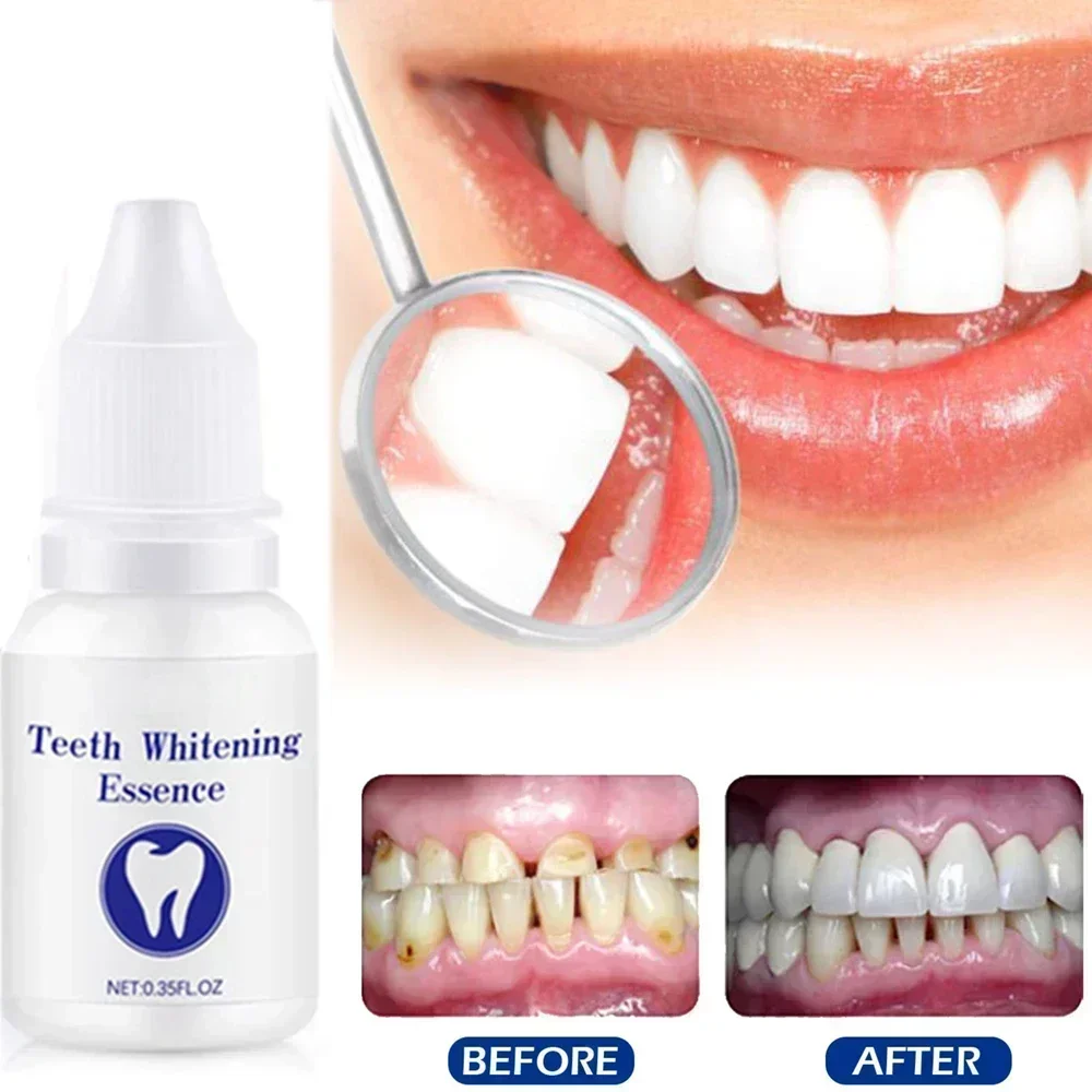 ²⁰²⁵ Natural Plant Extract To Repair Tooth Decay Whiten Teeth Remove Tooth Decay Cleaning Stain Remove Cigarette Stains Reduce Y