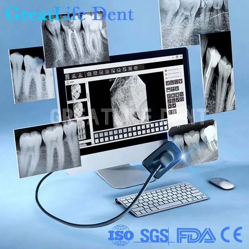 

Veterinary Clinics Dental Imaging System Intra Oral Digital X Ray Sensor Dental X Ray Sensor Rvg Dental Sensor