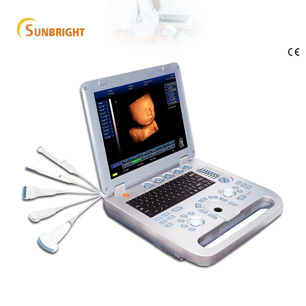 15 inches big LED laptop ultrasound scanner 3D 4D function medical ultrasound machine