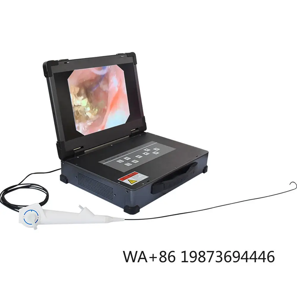 Single Use Digital Flexible Ureteroscope with built-in , disposable for urological minimally invasive examination operation