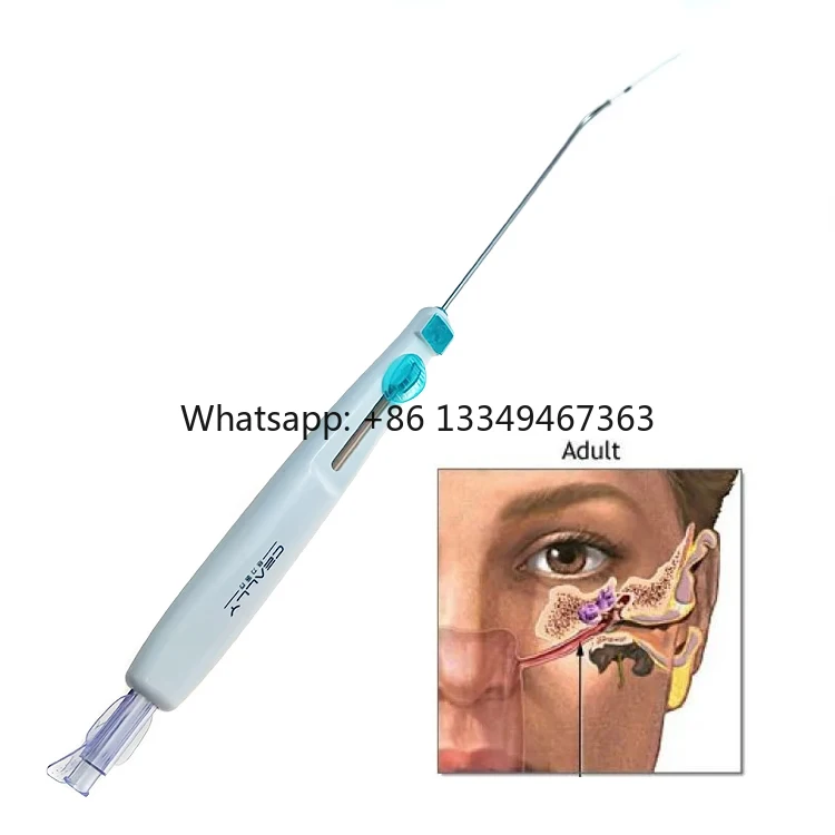 High Quality Eustachian Tube Balloon Dilation Catheter for Patients with Eustachian Tube Dysfunction