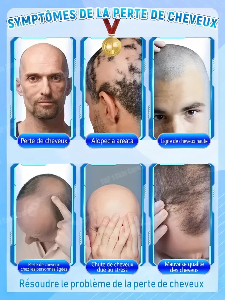 

Authoritative certified experts effectively repair baldness and hair, the most effective hair growth essential oil for 2024.
