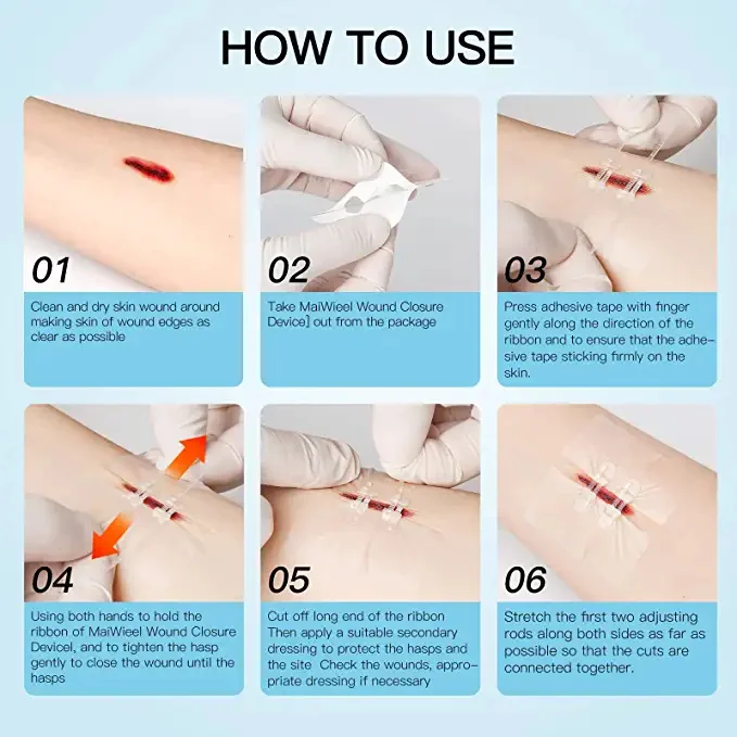 2PCS Zip Stitch Sutures BAND Kit Waterproof Strips Wound Closure Hospital Grade Laceration Kit  Painless Deco Band Aid