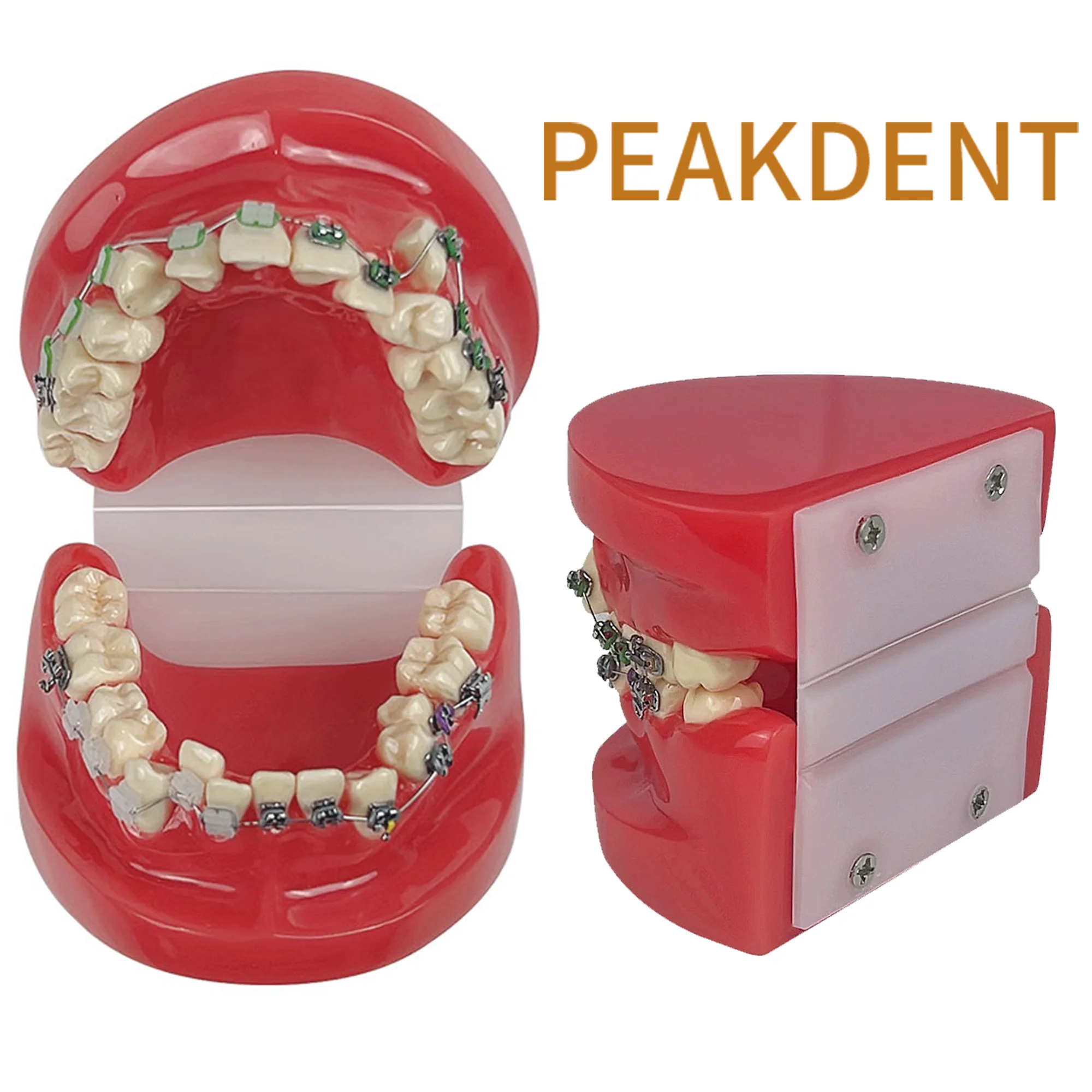 Orthodontic Teaching Model Dental Teeth Treatment Model With Metal & Ceramic Practice Studying Doctor-patient Communication