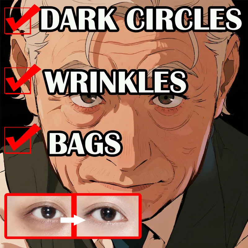 

Крем для удаления мешков под глазами, гиалуроновая кислота, укрепляющий кожу, выцветает тонкие линии, темные круги, мешки, отечность, подтяжка глаз, уход за кожей