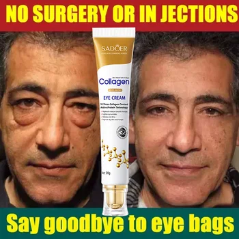 インスタント目袋除去クリームコラーゲン抗しわフェード小じわ肌の引き締め抗くまむくみ明るくアイケア