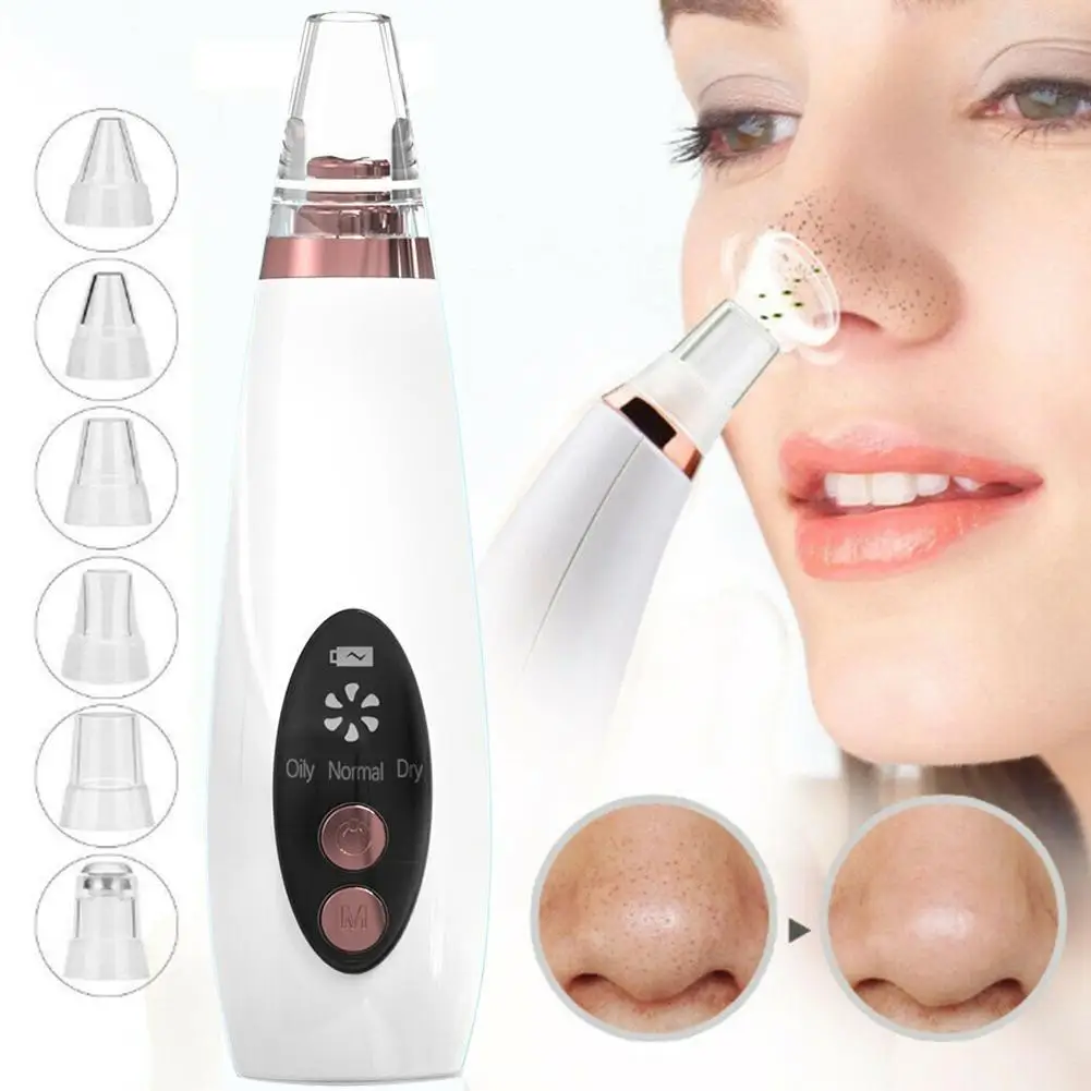 Facial Pore Comedondrukker USB Oplaadbare Mee-eter Zuigkit Met 6 soorten zuigkop Pore Cleaning Care Tool