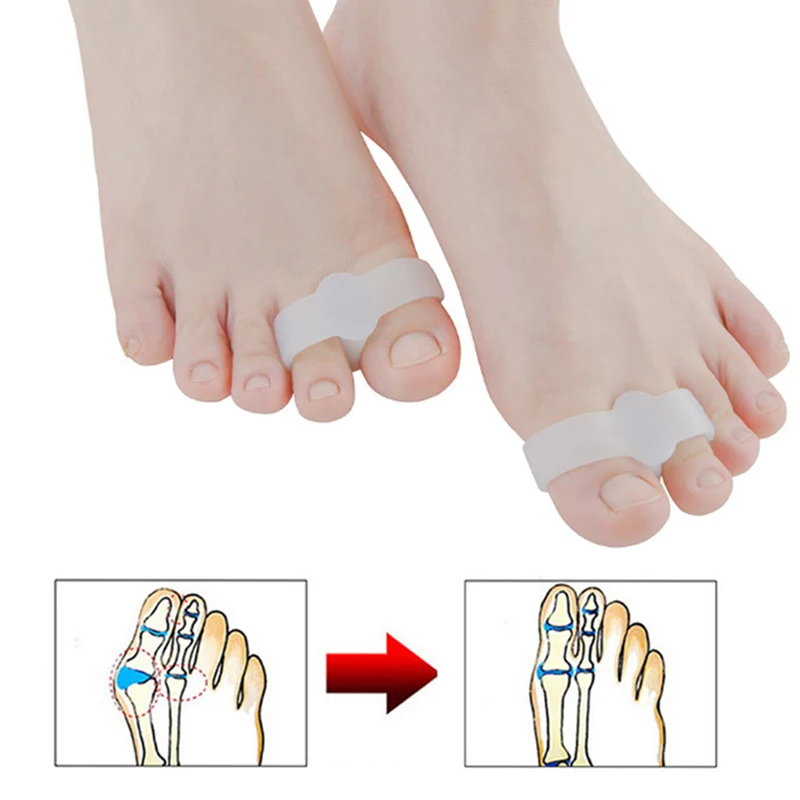 Silicone toe separador, corretor hálux valgo, alívio da dor do pé, 2pcs