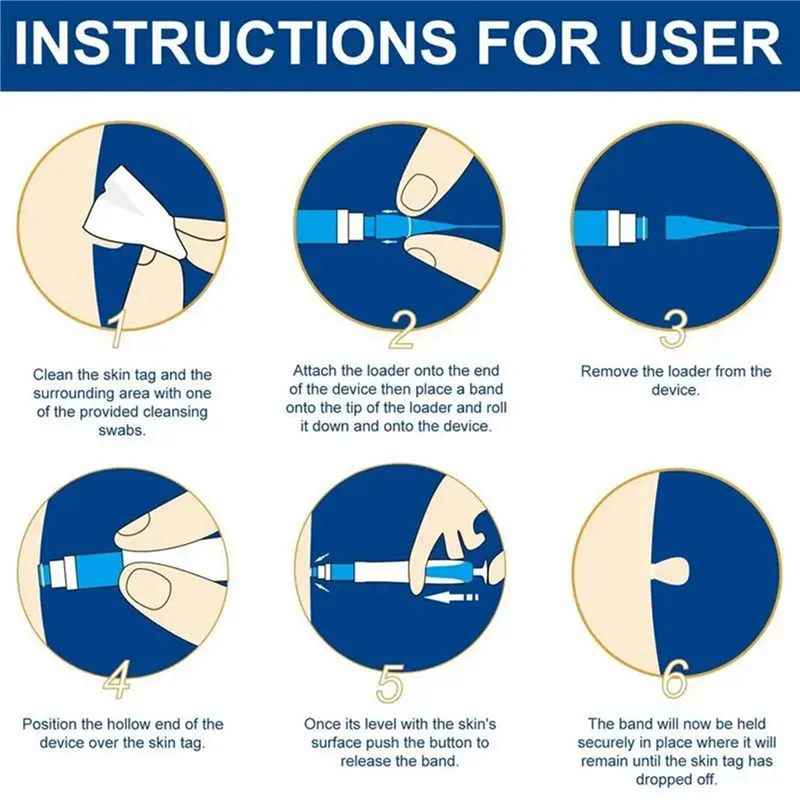 【¡Venta flash!】2X Kit de eliminación de etiquetas de piel pluma de eliminación de etiquetas de piel indolora dispositivo de eliminación de etiquetas de piel fácil elimina las etiquetas de la piel de 4Mm-9Mm