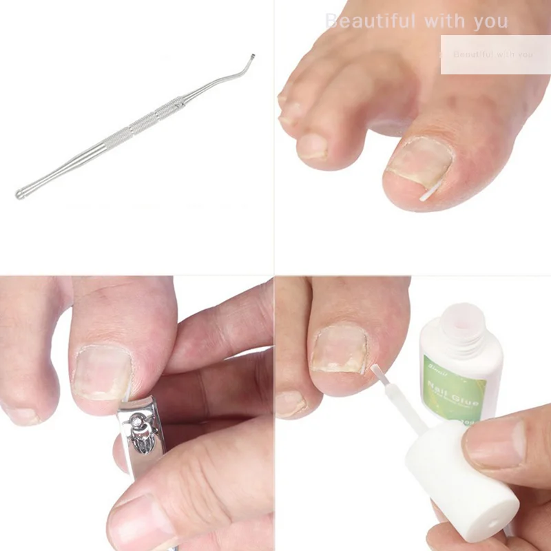 10 unids/pack Clip alisador de uñas de los pies herramienta de corrección de uñas encarnadas tratamiento de uñas parche elástico pegatina cuidado de los pies pedicura
