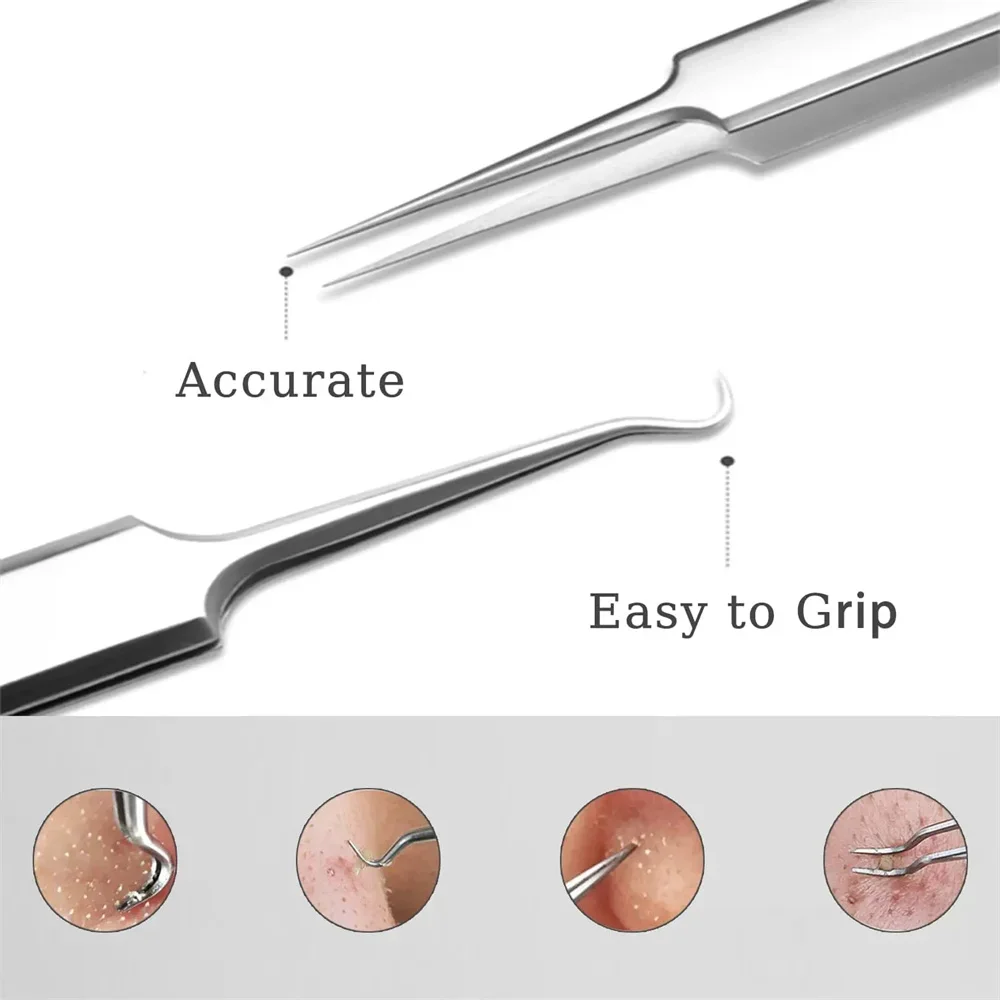 초미세 No. 5 셀 여드름 블랙헤드 클립 트위저, 미용실 특수 스크래핑 및 클로징 아티팩트 여드름 바늘 도구, 1PC