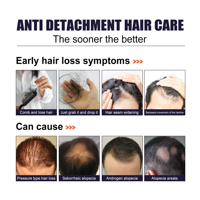 Tinh dầu chăm sóc tóc Nuôi dưỡng chân tóc Cải thiện sự phân chia thúc đẩy tăng trưởng