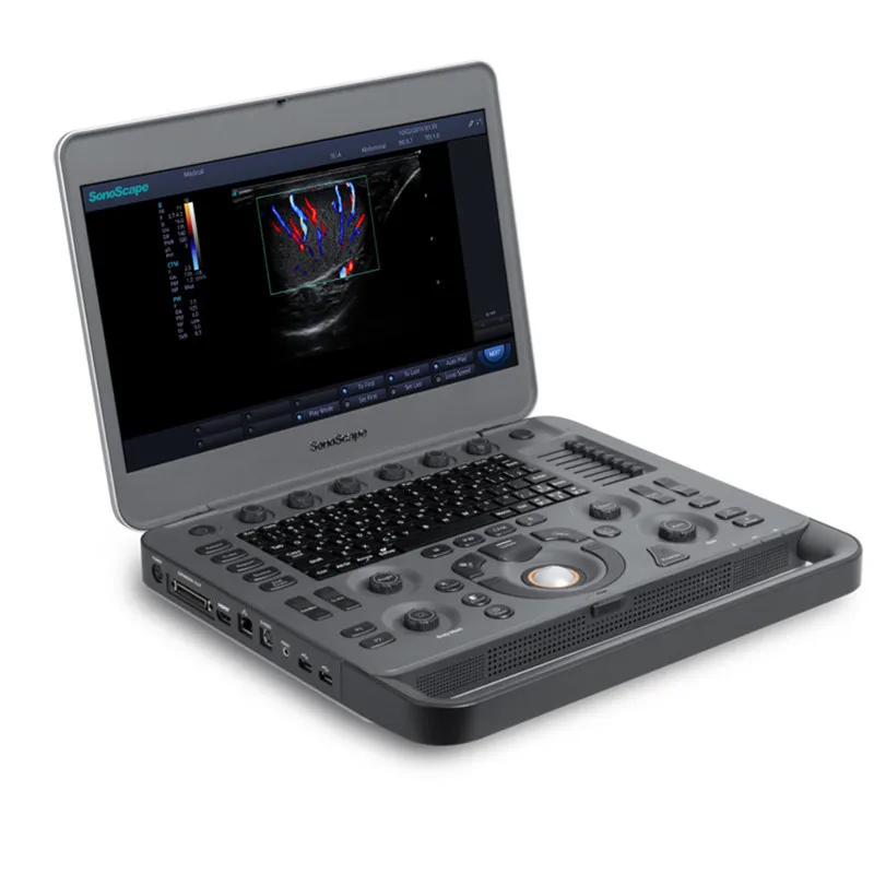 SonoScape X5 Laptop Styled Impressive High Definition Digital Laptop Color Doppler Veterinary Laptop Ultrasound Instrument