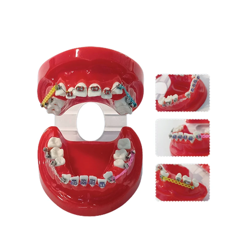 Dental Teaching Model with Buccal Tubes Oral Teeth Restoration Practice Display Orthodontics Demonstration Dentistry Models