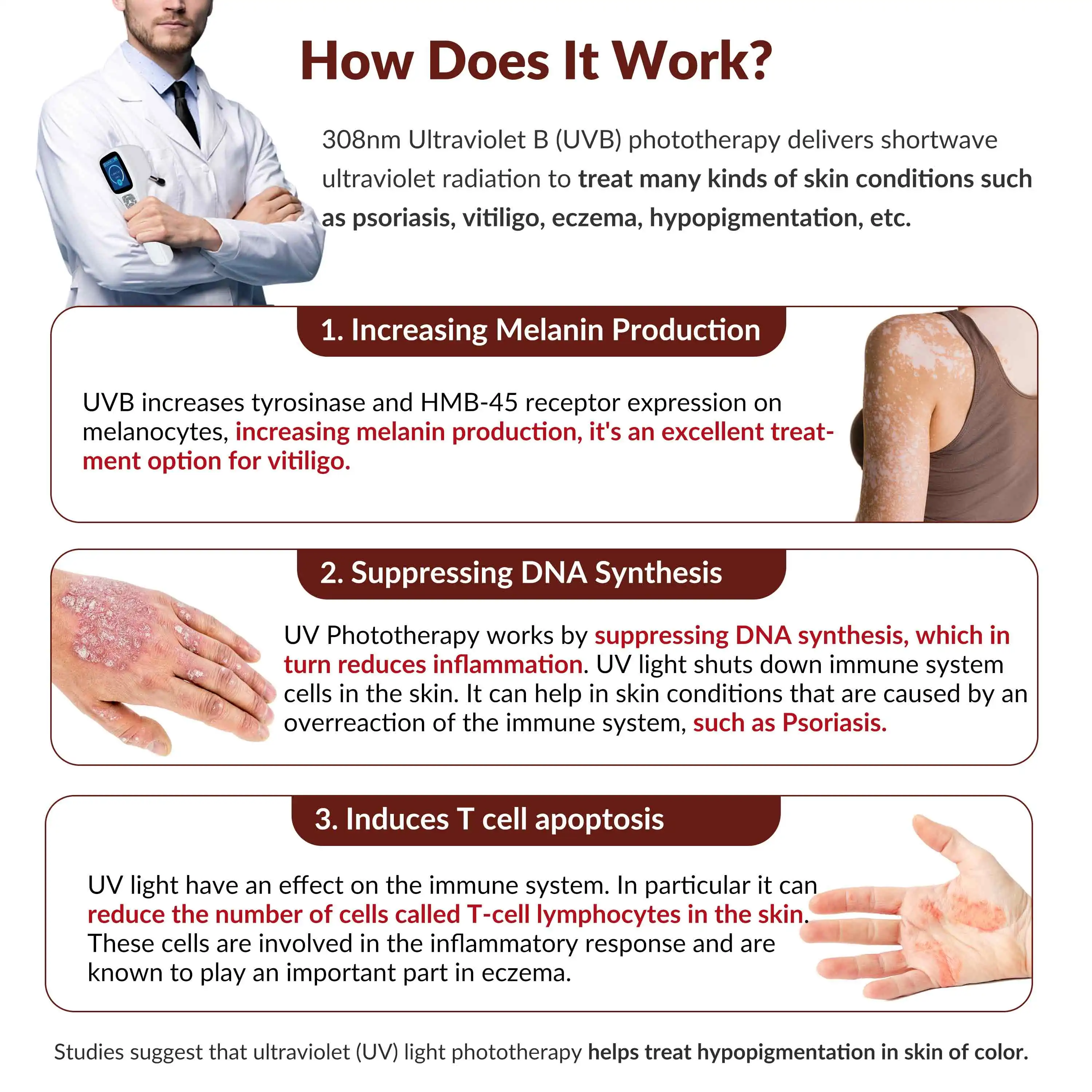 2026 Clinical Grade 308nm Excimer  Effective Ultraviolet Light Therapy for Vitiligo Treatment