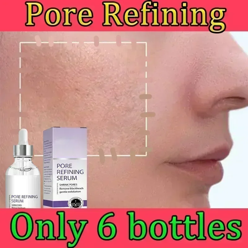 Pore Narrowing Essence Hydrating Essence Hydrating Essence Hydrating Dry Skin Hyaluronic Acid  Cream090409