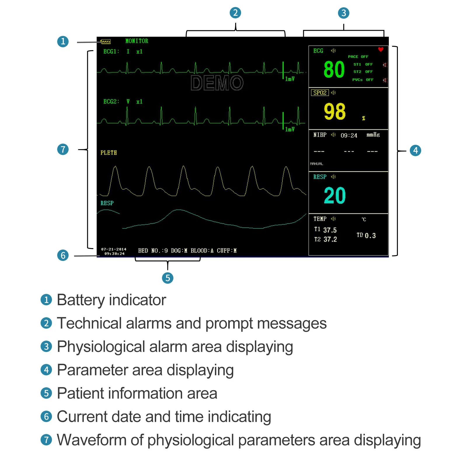 CONTEC-Monitor veterinário portátil do paciente do veterinário, monitor do sinal vital, impressora e opção do Etco2, ECG, NIBP, RESP, SPO2, PR, TEMP, 8"