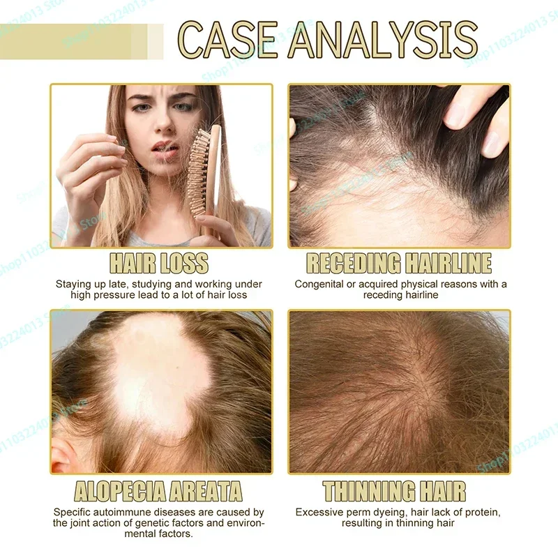 

Sdottor Unisex Hair Growth Oil Hair Loss Treatment Rapid Effective Baldness Repair Hereditary Postpartum Hair Loss