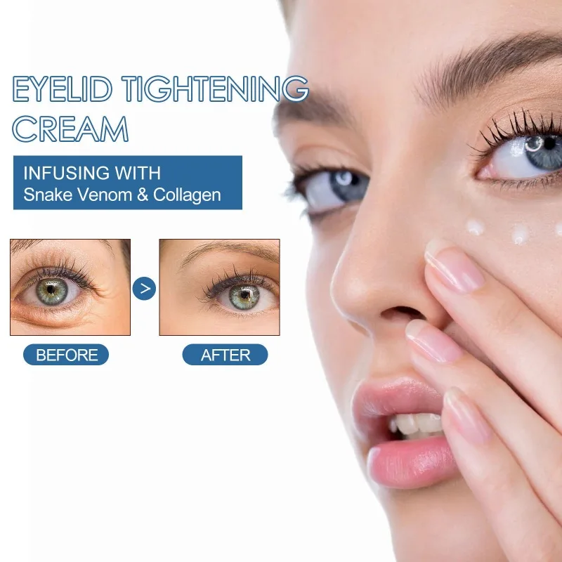 كريم شد الجفن المضاد للشيخوخة لتقليل الترهل للعيون الشبابية #2