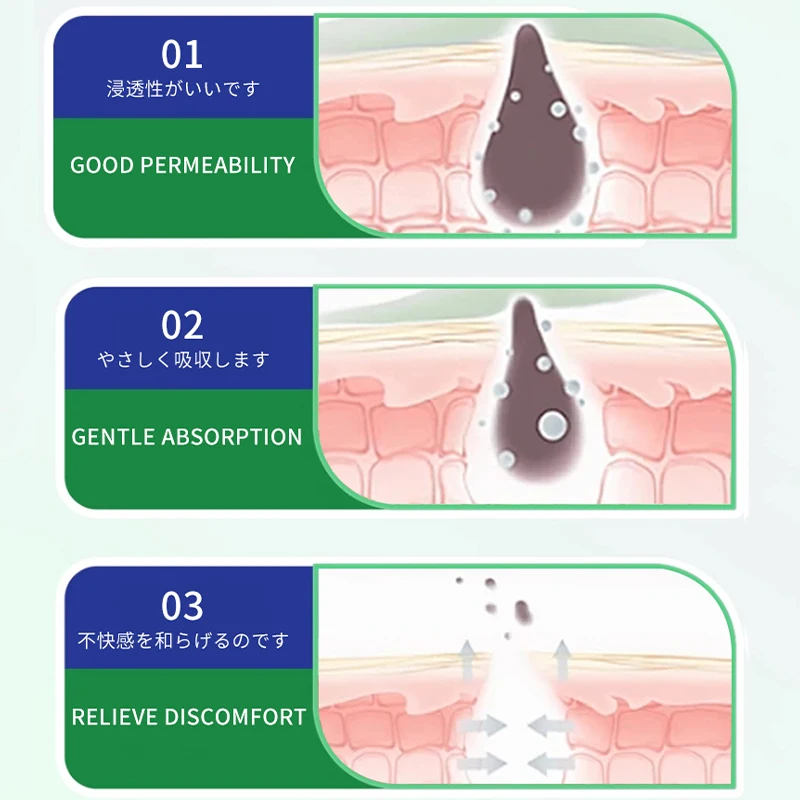 Rosacea-zalf - een actuele gezondheid - Verzorgingspasta voor neusroodheid, vergrote poriën, gebroken capillaires, mee-eters en gerelateerde drosacea-zalf - Een actuele gezondheid - verzorgingspasta voor neusroodheid, vergrote poriën, gebroken