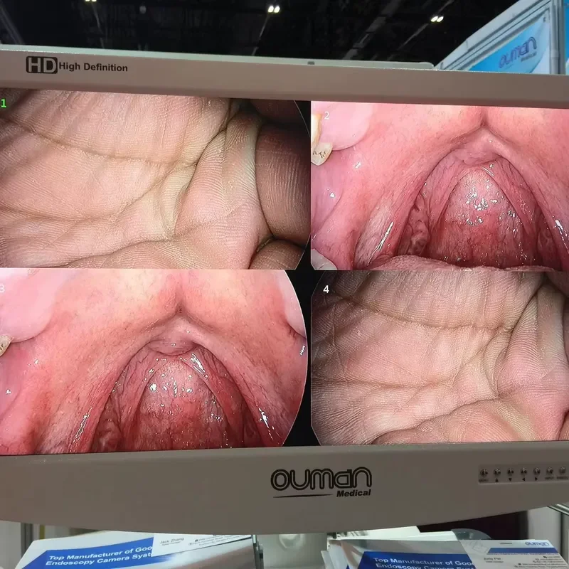 Medical Monitor Display Monitors Equipment Complete HD Endoscopic Camera System LCD Monitor Screen