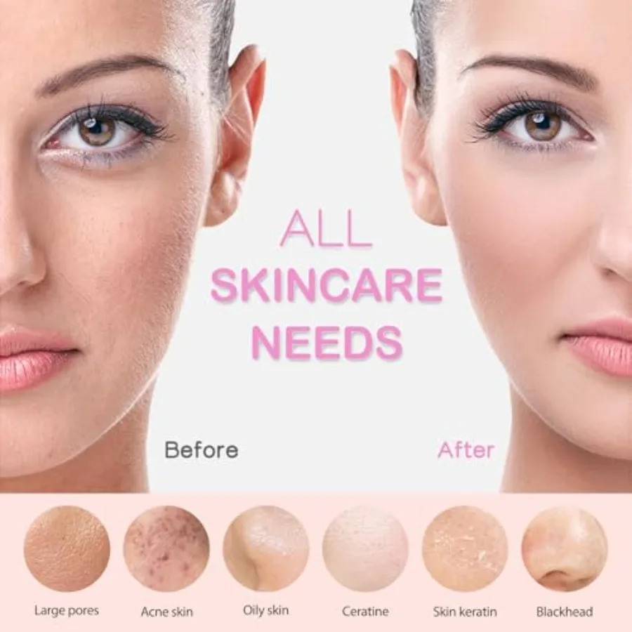 Sikat Pembersih Wajah PRITECH Rechargeable Silikon dengan Pijat Panas dan Getaran untuk Eksfoliasi Mendalam