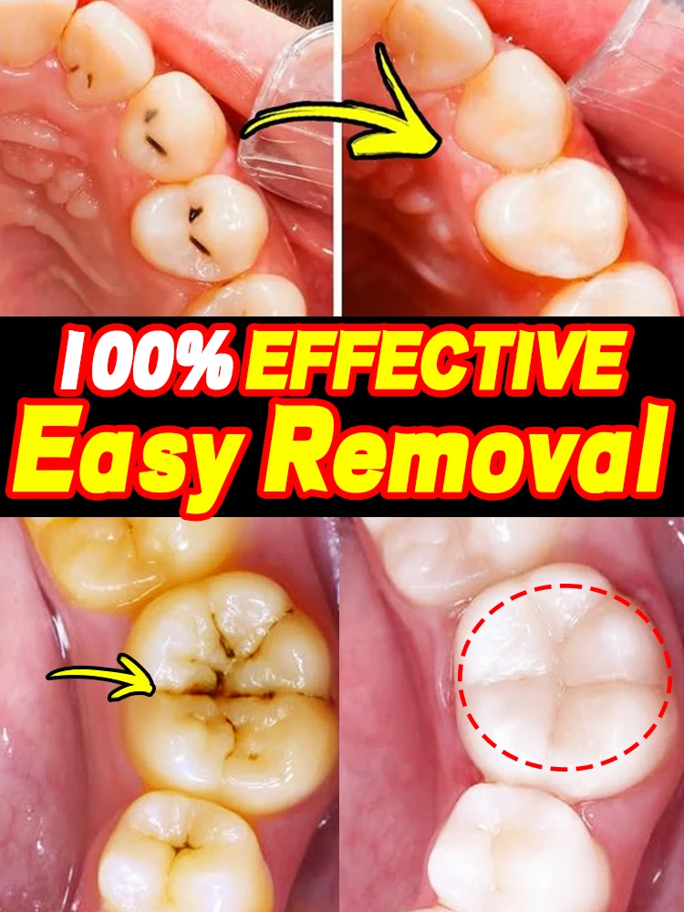 

ᴰᵉⁿᵗⁱˢᵗ ʳᵉᶜᵒᵐᵐᵉⁿᵈᵉᵈ⸴ ᵖʳᵒᶠᵉˢˢⁱᵒⁿᵃˡ ʷʰⁱᵗᵉⁿⁱⁿᵍ