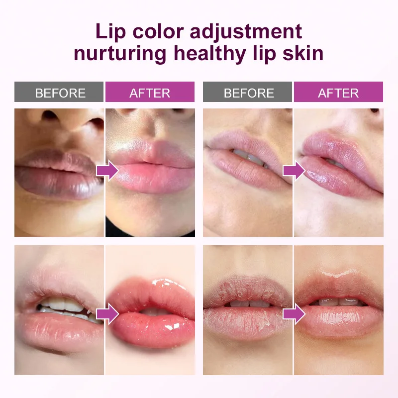 Remove Dark Lip Balm Fast Lightening Pink Lip Exfoliating Fade Lip Line Dead Skin Moisturizer Korean Care Products Beauty Health