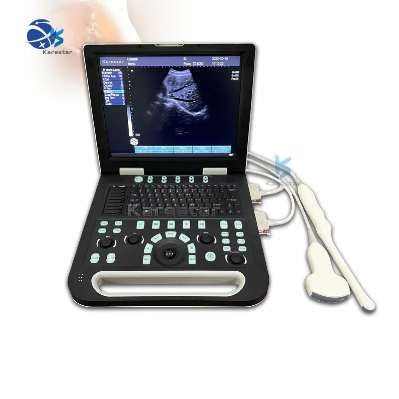 equipment ultrasound 3D/4D/5D high frequency laptop Doppler ultrasound machine Equal to Sonoscape E1/E2/E3 Mindray ultrasound