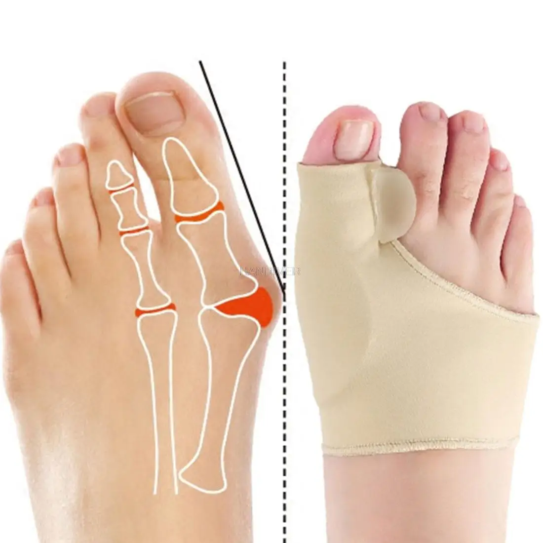 2 Stuks = 1 Paar Teen Corrector Orthesen Voeten Voetverzorging Bone Duim Richter Correctie Zachte Pedicure Sokken Bunion stijltang