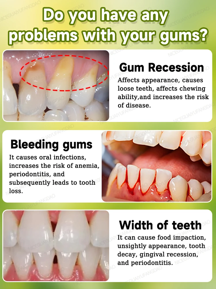 Repair damaged gums, relieve gum pain, strengthen gums, and restore healthy gums