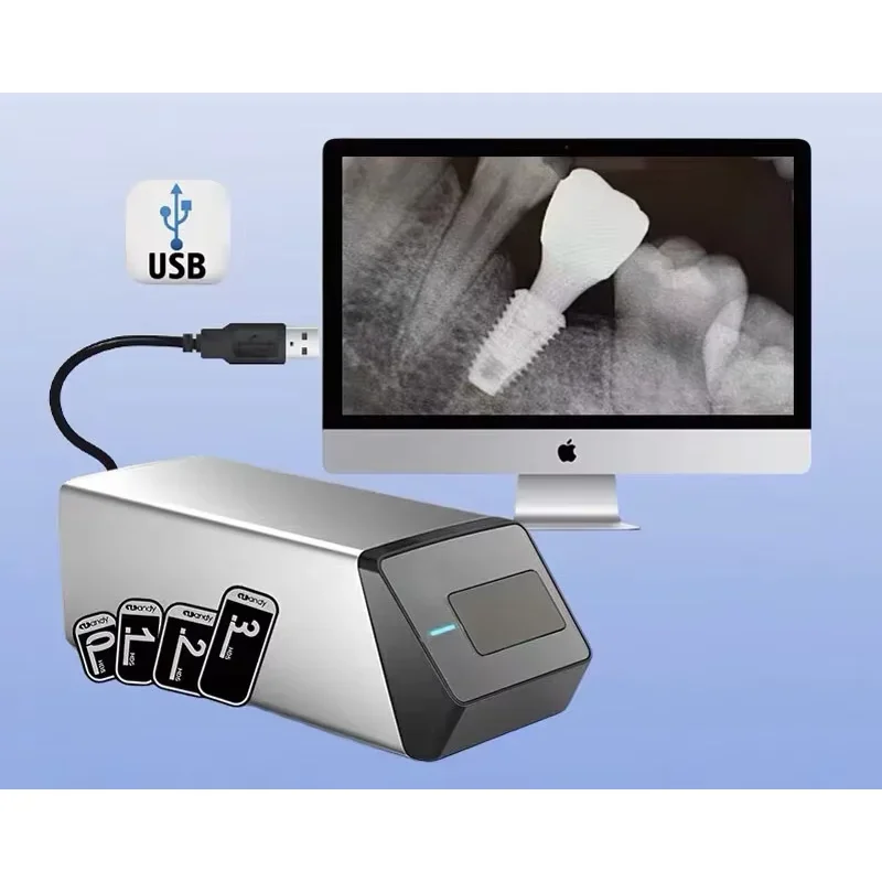 2026 20253 Seconds Fast Scanning PSP X-Ray Scanner Intraoral CR Scanning Machine Compatible Windows7\8\10, Mac, Linux