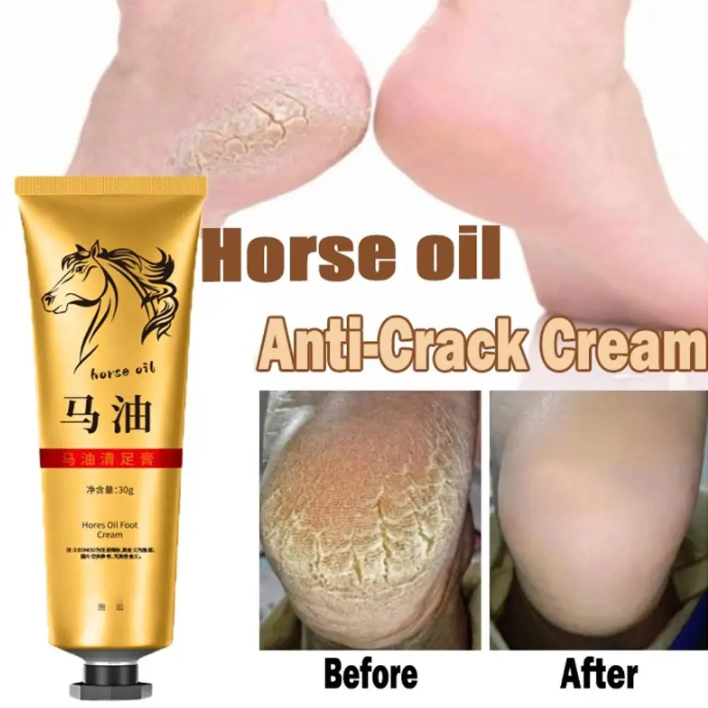 Crema antigrietas para pies, crema de caballo para reparación de talón agrietado, cuidado de la piel de las manos, eliminación de callos, piel muerta, suave O M3O9, 30G