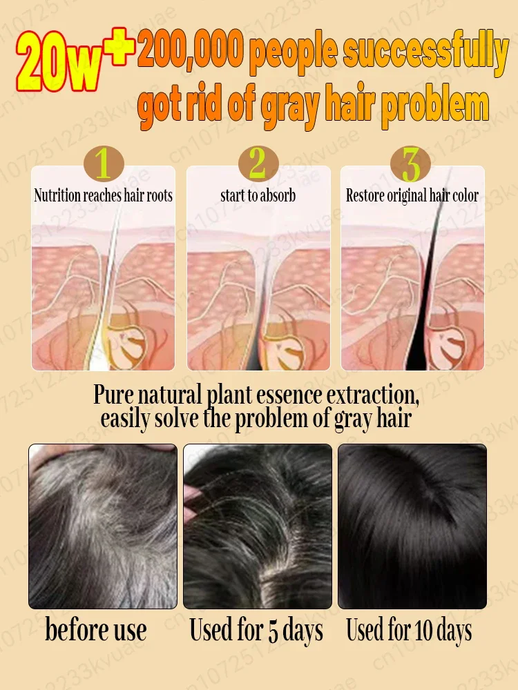 White hair killer, remove gray hair and restore natural hair color in 7 days