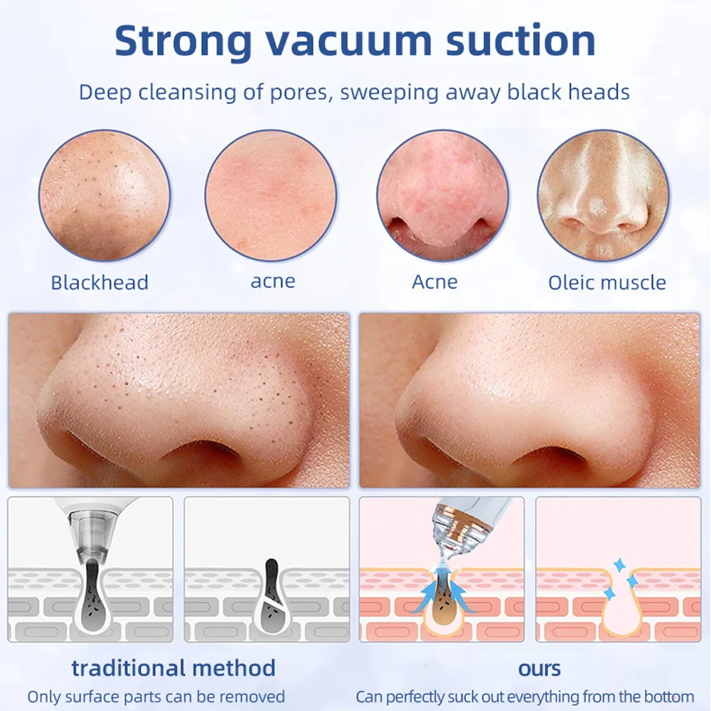 Skin Care Pore Cleaning Blackhead Electric Facial Nose Cleaner baeuty Tools