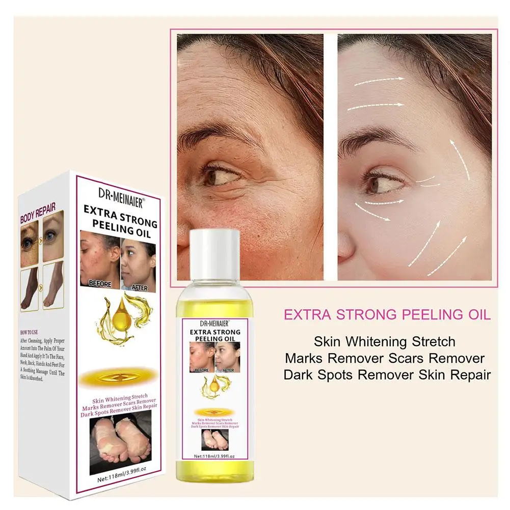 Gelbes Peeling öl Bleichen dunkle Haut flecken entfernen abgestorbene Haut aufhellen Peeling Peeling weiß befeuchten Körper hautpflege