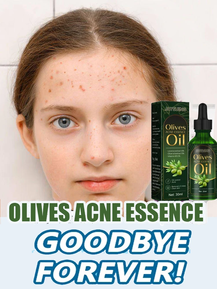 

Skin Care Moisturizing Oil Acne Removal Serum Shrink Pores Oil-Control Brighten Serum,Diminish Acne, Repair Redness