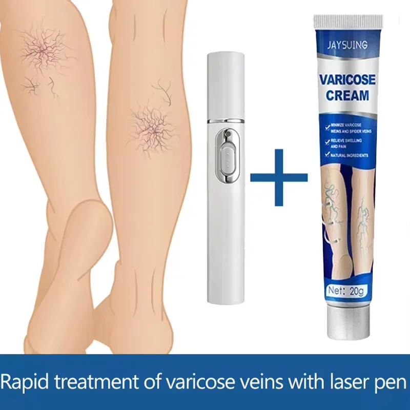 Абажурная терапия Варикоцеле улучшает флебит нижней конечности и расширенный васкулит, способствует кровообращению. Абажурная терапия Варикоцеле улучшает флебит нижней конечности и расширенный васкулит, способствует кровообращению.