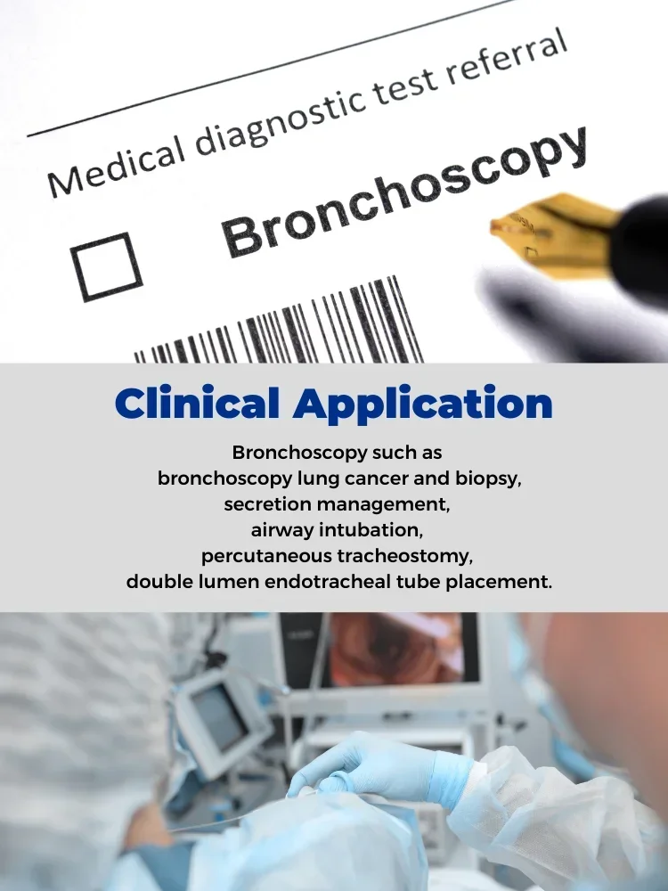 Flexible Disposable Bronchoscope Nasolaryngoscope Bronchoscope ENT Endoscopy