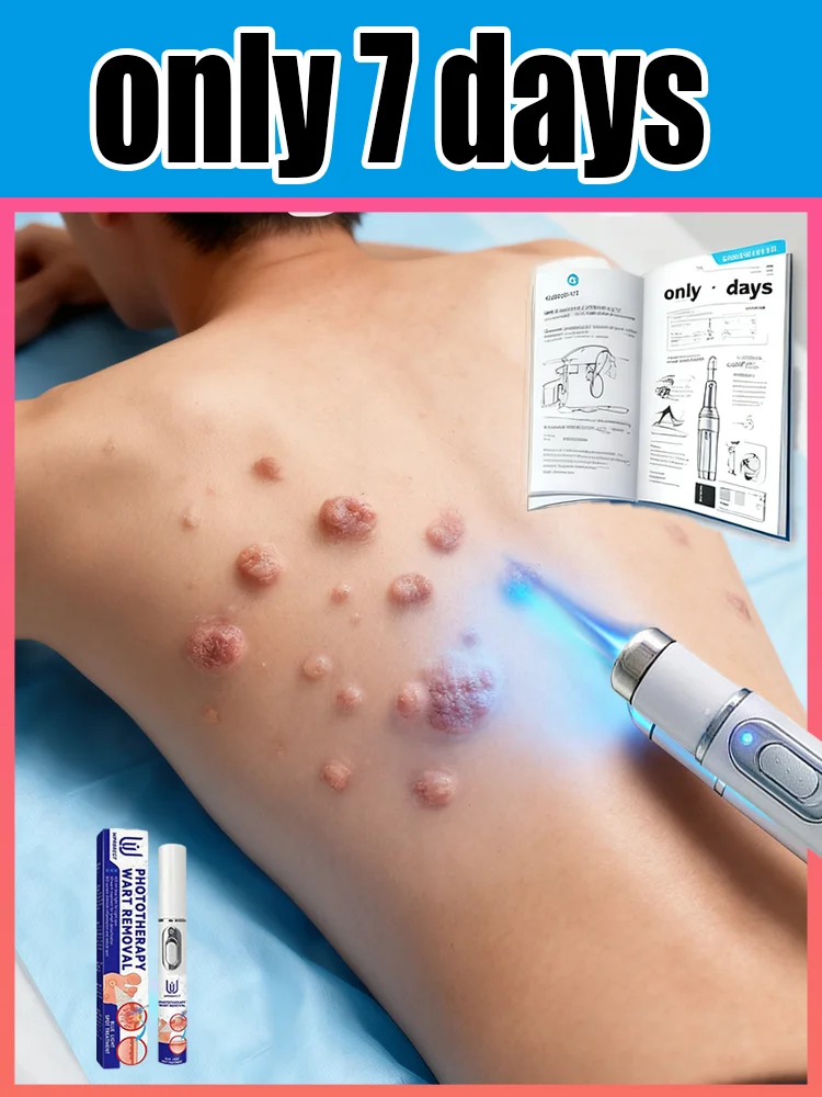 

Gᴇɴᴇʀᴀᴛɪᴏɴ-3 Lᴀsᴇʀ Sᴀʏs Gᴏᴏᴅʙʏᴇ Tᴏ Wᴀʀᴛs Iɴ 7 Dᴀʏs