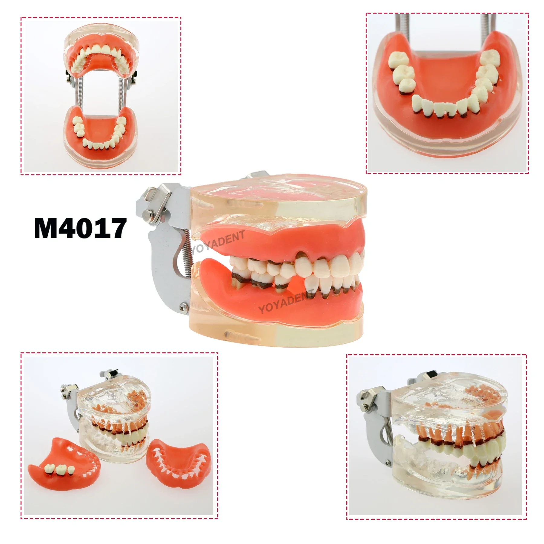 

Dental Teeth Model Dentistry Periodontal Disease Pathological Teaching Demo Model