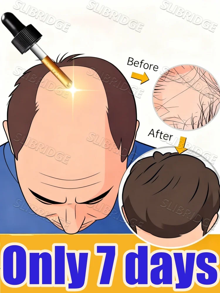 2025-combatte-i-capelli-fini-e-piatti-rafforzare-e-ricrescere-vedi-risultati-in-solo-1-settimana