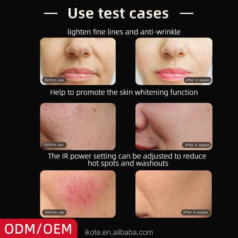 Masajeador de belleza 3 en 1 para uso doméstico, tecnologías de vibración térmica LED para un estiramiento firme y cuidado de la piel suave, mejora del rostro y el cuello