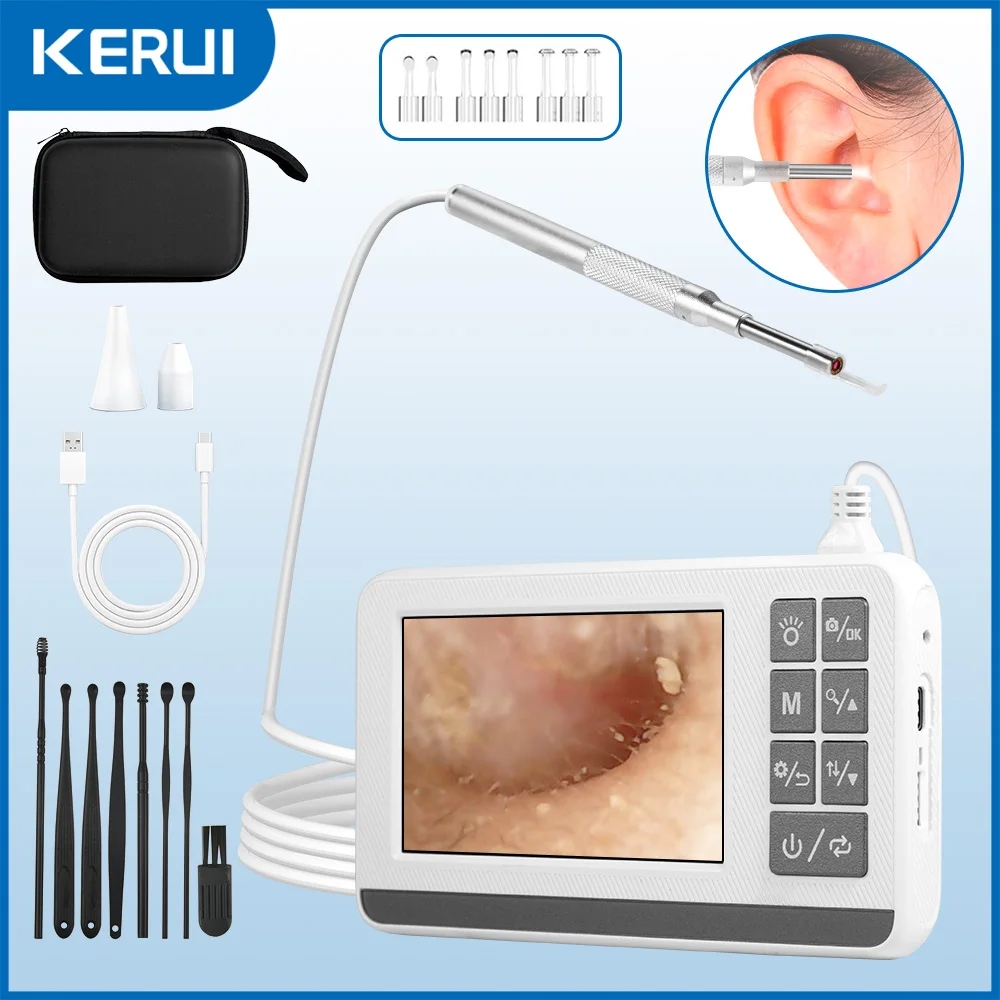KERUI 4.3 Inch IPS Screen Otoscope Camera Earwax Removal 3.9MM Ear Inspection Endoscope Waterproof Ear Cleaner Ear Pick Tool